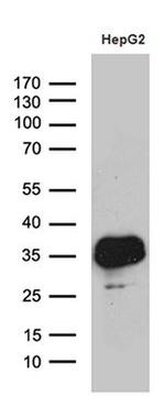 SULT1A3 Antibody in Western Blot (WB)