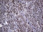 ZBTB4 Antibody in Immunohistochemistry (Paraffin) (IHC (P))