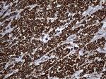 UQCRFS1 Antibody in Immunohistochemistry (Paraffin) (IHC (P))