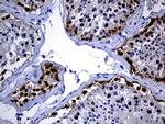 IGF2BP3 Antibody in Immunohistochemistry (Paraffin) (IHC (P))