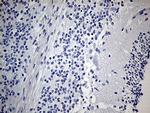 IGF2BP3 Antibody in Immunohistochemistry (Paraffin) (IHC (P))