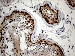 IGF2BP3 Antibody in Immunohistochemistry (Paraffin) (IHC (P))