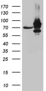 IGF2BP3 Antibody in Western Blot (WB)