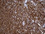 SH3BP1 Antibody in Immunohistochemistry (Paraffin) (IHC (P))