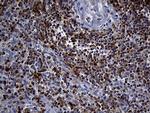 SH3BP1 Antibody in Immunohistochemistry (Paraffin) (IHC (P))