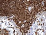 SH3BP1 Antibody in Immunohistochemistry (Paraffin) (IHC (P))