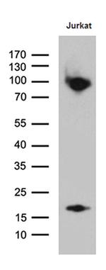 SH3BP1 Antibody in Western Blot (WB)