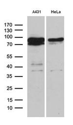 EEF1D Antibody in Western Blot (WB)