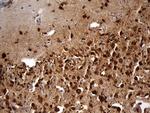 EEF1D Antibody in Immunohistochemistry (Paraffin) (IHC (P))