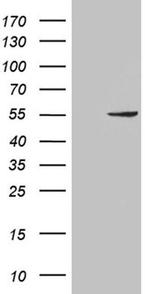 PNLIP Antibody in Western Blot (WB)