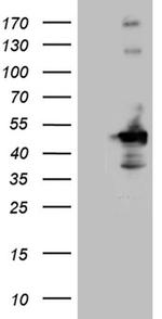 HOMER1 Antibody in Western Blot (WB)