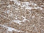 ACADM Antibody in Immunohistochemistry (Paraffin) (IHC (P))