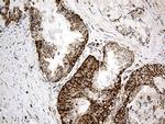 ACADM Antibody in Immunohistochemistry (Paraffin) (IHC (P))