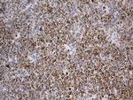 ACADM Antibody in Immunohistochemistry (Paraffin) (IHC (P))