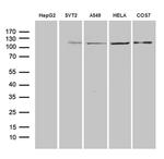 IDE Antibody in Western Blot (WB)