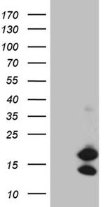 CHCHD10 Antibody in Western Blot (WB)