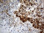 CHCHD10 Antibody in Immunohistochemistry (Paraffin) (IHC (P))