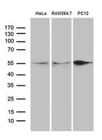 SNX4 Antibody in Western Blot (WB)