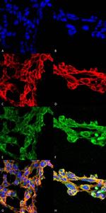 7-Ketocholesterol Antibody in Immunocytochemistry (ICC/IF)