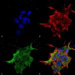 NALCN Antibody in Immunocytochemistry (ICC/IF)