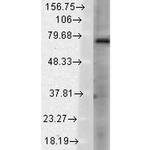 TRPV3 Antibody in Western Blot (WB)