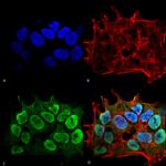 SHANK3 Antibody in Immunocytochemistry (ICC/IF)