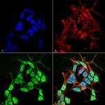 SCN3B Antibody in Immunocytochemistry (ICC/IF)