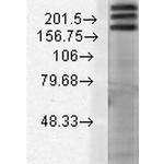 SHANK1 Antibody in Western Blot (WB)