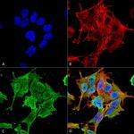 ASIC1 Antibody in Immunocytochemistry (ICC/IF)