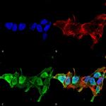 MFN2 Antibody in Immunocytochemistry (ICC/IF)