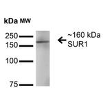 SUR1 Antibody in Western Blot (WB)