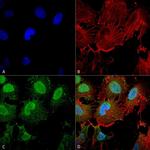 mGluR5 Antibody in Immunocytochemistry (ICC/IF)