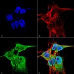 FGF13 Antibody in Immunocytochemistry (ICC/IF)