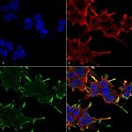 CRYAB Antibody in Immunocytochemistry (ICC/IF)