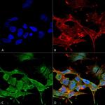 CLCN3 Antibody in Immunocytochemistry (ICC/IF)