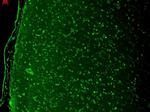 CaV1.3 Antibody in Immunohistochemistry (Paraffin) (IHC (P))