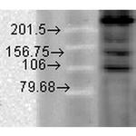 CaV1.2 Antibody in Western Blot (WB)