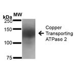 ATP7B Antibody in Western Blot (WB)