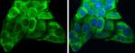 ATP6V1A Antibody in Immunocytochemistry (ICC/IF)