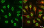 Phospho-ATR (Thr1989) Antibody in Immunocytochemistry (ICC/IF)