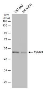 CaMKII delta Antibody in Western Blot (WB)