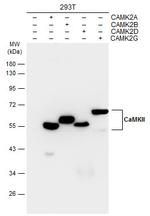 CaMKII delta Antibody in Western Blot (WB)