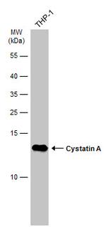 Cystatin A Antibody in Western Blot (WB)