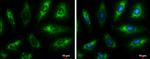 Fumarase Antibody in Immunocytochemistry (ICC/IF)