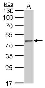 Fumarase Antibody in Western Blot (WB)