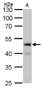 Fumarase Antibody in Western Blot (WB)