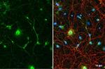 Glutamine Synthetase Antibody in Immunocytochemistry (ICC/IF)