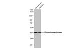 Glutamine Synthetase Antibody in Western Blot (WB)