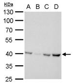 Glutamine Synthetase Antibody in Western Blot (WB)