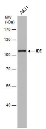 IDE Antibody in Western Blot (WB)